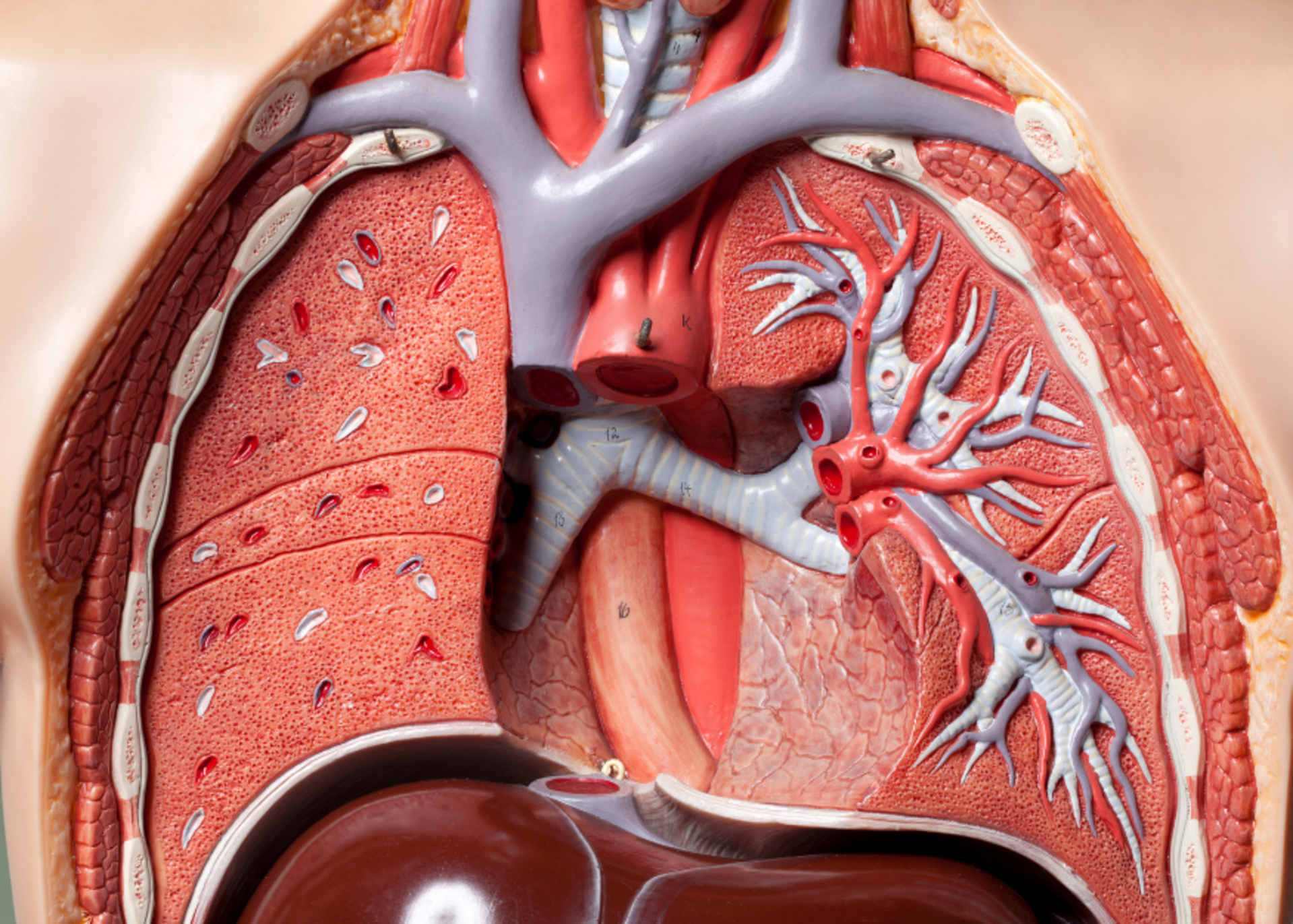 Pulmonary Embolism Treatment